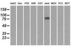 Image no. 2 for anti-SATB Homeobox 1 (SATB1) antibody (ABIN1500812) (SATB1 抗体)