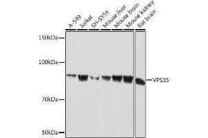 Western blot analysis of extracts of various cell lines, using VPS35 Rabbit mAb (ABIN7271276) at 1:1000 dilution. (VPS35 抗体)