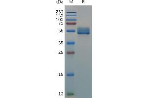 Canis IL18BP Protein, hFc Tag on SDS-PAGE under reducing condition. (IL18BP Protein (AA 31-192) (Fc Tag))