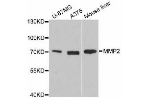 Western blot analysis of extracts of various cell lines, using MMP2 antibody (ABIN5973678) at 1/10000 dilution. (MMP2 抗体)