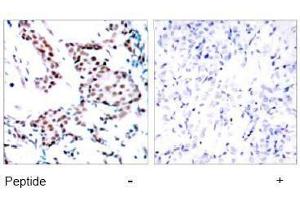 Image no. 1 for anti-Jun Proto-Oncogene (JUN) (Tyr170) antibody (ABIN197133) (C-JUN 抗体  (Tyr170))