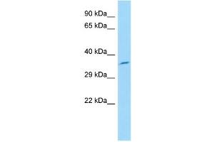 Host: Rabbit Target Name: Glt1d1 Sample Type: Rat Pancreas lysates Antibody Dilution: 1. (GLT1D1 抗体  (N-Term))