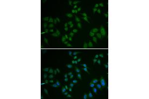 Immunofluorescence analysis of U2OS cells using TP63 antibody. (TCP1 alpha/CCTA 抗体)