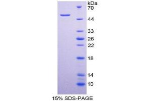 SDS-PAGE (SDS) image for Interleukin 28A (Interferon, lambda 2) (IL28A) (AA 26-200) protein (His tag,GST tag) (ABIN1980984) (IL28A Protein (AA 26-200) (His tag,GST tag))