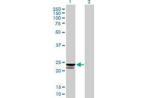 Lane 1: PTRH1 transfected lysate ( 22. (PTRH1 293T Cell Transient Overexpression Lysate(Denatured))