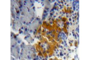 Used in DAB staining on fromalin fixed paraffin-embedded Pancreas tissue (ICAM4 抗体  (AA 23-227))