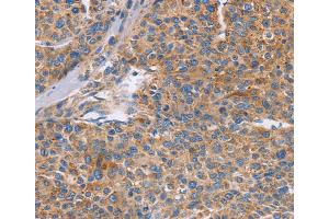 Immunohistochemistry (IHC) image for anti-Cell Division Cycle 7 (CDC7) antibody (ABIN2432826) (CDC7 抗体)