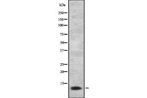 Western blot analysis of Prostate Stem Cell Antigen using LOVO whole cell lysates (PSCA 抗体)