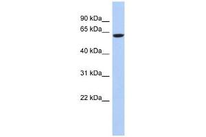 CAMKV antibody used at 1 ug/ml to detect target protein. (CAMKV 抗体  (N-Term))