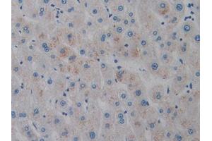 Used in DAB staining on fromalin fixed paraffin- embedded liver tissue (AMELX 抗体  (AA 49-187))
