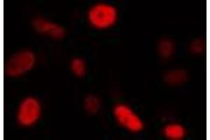 ABIN6274340 staining Hela cells by IF/ICC. (FOXE3 抗体  (Internal Region))