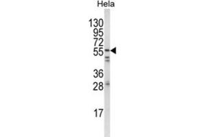 Western Blotting (WB) image for anti-FYN Oncogene Related To SRC, FGR, YES (FYN) antibody (ABIN3003446) (FYN 抗体)