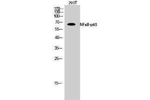 Western Blotting (WB) image for anti-Nuclear Factor-kB p65 (NFkBP65) (Thr735) antibody (ABIN3176329) (NF-kB p65 抗体  (Thr735))