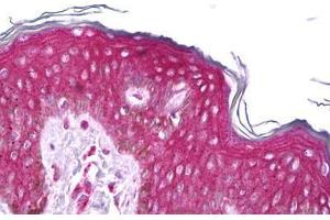 Anti-RET antibody IHC staining of human skin. (Ret Proto-Oncogene 抗体  (AA 152-182))