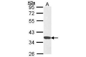 CDK6 抗体