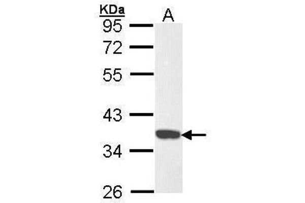 CDK6 抗体