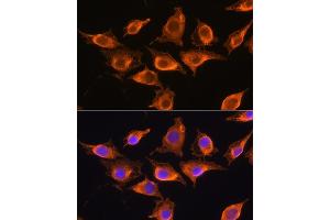 Immunofluorescence analysis of L929 cells using ZCCHC11 Rabbit pAb (ABIN6128939, ABIN6150406, ABIN6150407 and ABIN6221650) at dilution of 1:100. (ZCCHC11 抗体  (AA 1-290))