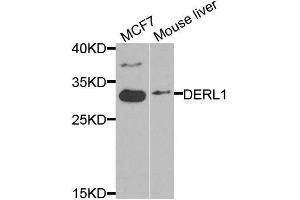 Western blot analysis of extracts of various cell lines, using DERL1 antibody (ABIN5974694) at 1/1000 dilution. (DERL1 抗体)