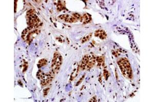 Immunohistochemistry (IHC) image for anti-Melanoma Antigen Family A, 4 (MAGEA4) antibody (ABIN3002532) (MAGEA4 抗体)