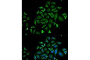 Immunofluorescence analysis of HeLa cells using FGFR1 Polyclonal Antibody (FGFR1 抗体)