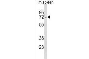 Western Blotting (WB) image for anti-Ectonucleoside Triphosphate diphosphohydrolase 4 (ENTPD4) antibody (ABIN3000013) (ENTPD4 抗体)