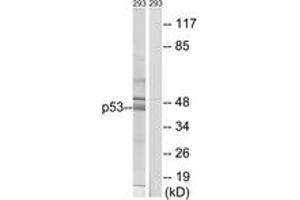 Western blot analysis of extracts from 293 cells, using p53 (Ab-378) Antibody. (p53 抗体  (AA 336-385))