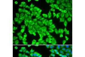 Immunofluorescence analysis of HeLa cells using STIP1 Polyclonal Antibody (STIP1 抗体)