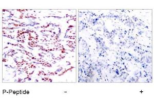 Image no. 1 for anti-Activating Transcription Factor 2 (ATF2) (pThr53), (pThr71) antibody (ABIN196666) (ATF2 抗体  (pThr53, pThr71))