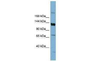 ABCB4 antibody used at 0. (ABCB4 抗体)