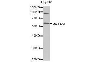 Western Blotting (WB) image for anti-UDP Glucuronosyltransferase 1 Family, Polypeptide A1 (UGT1A1) antibody (ABIN1875274) (UGT1A1 抗体)