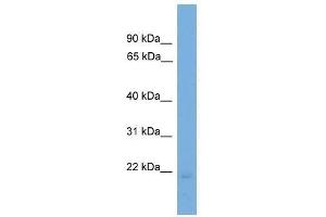 Western Blot showing EDN2 antibody used at a concentration of 1-2 ug/ml to detect its target protein. (Endothelin 2 抗体  (N-Term))