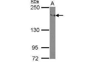 WB Image Sample (30 ug of whole cell lysate) A: THP-1 5% SDS PAGE antibody diluted at 1:500 (ITGAL 抗体  (Center))