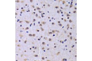 Immunohistochemistry of paraffin-embedded rat brain using NUDC antibody. (NUDC 抗体  (AA 1-331))