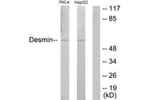 Western Blotting (WB) image for anti-Desmin (DES) (AA 26-75) antibody (ABIN2888927) (Desmin 抗体  (AA 26-75))