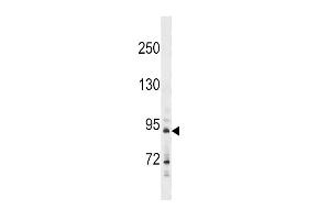 Western blot analysis in A549 cell line lysates (35ug/lane). (HHIP 抗体  (N-Term))