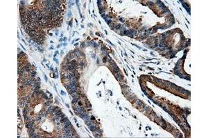 Immunohistochemistry (IHC) image for anti-Intraflagellar Transport 57 Homolog (IFT57) antibody (ABIN1498809) (IFT57 抗体)