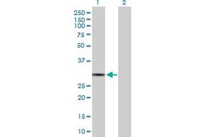 Lane 1: HLA-DQA1 transfected lysate ( 28. (HLA-DQA1 293T Cell Transient Overexpression Lysate(Denatured))