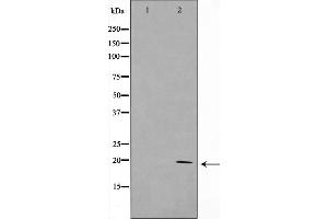 Western blot analysis on HepG2 cell lysate using KAD6 Antibody，The lane on the left is treated with the antigen-specific peptide. (TAF9 抗体  (Internal Region))