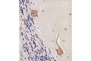 (ABIN6244287 and ABIN6577245) staining CK2 in human cerebellum tissue sections by Immunohistochemistry (IHC-P - paraformaldehyde-fixed, paraffin-embedded sections). (CAMK2B 抗体  (AA 1-503))