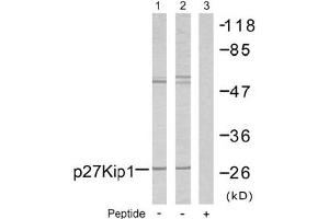 Image no. 2 for anti-Cyclin-Dependent Kinase Inhibitor 1B (p27, Kip1) (CDKN1B) (Ser10) antibody (ABIN197350) (CDKN1B 抗体  (Ser10))
