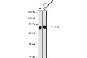 Western blot analysis of extracts of various cell lines, using TRIP2 antibody (ABIN6129947, ABIN6149464, ABIN6149465 and ABIN6222516) at 1:500 dilution. (TRAF3IP2 抗体  (AA 1-300))