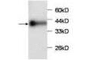 Image no. 1 for anti-Chemokine (C-C Motif) Ligand 2 (CCL2) antibody (ABIN791500) (CCL2 抗体)