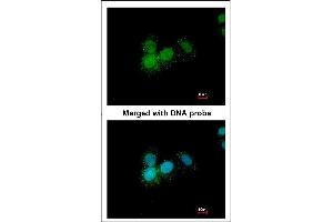 Immunofluorescence analysis of paraformaldehyde-fixed A549, using Progesterone receptor antibody at 1:200 dilution. (Progesterone Receptor 抗体)