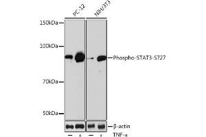 Western blot analysis of extracts of various cell lines, using Phospho-ST-S727 Rabbit mAb (ABIN6135339, ABIN6136294, ABIN6136295 and ABIN7101885) at 1:1000 dilution. (STAT3 抗体  (pSer727))