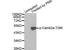 Western Blotting (WB) image for anti-Calcium/calmodulin-Dependent Protein Kinase II alpha (CAMK2A) (pThr286) antibody (ABIN1870029) (CAMK2A 抗体  (pThr286))