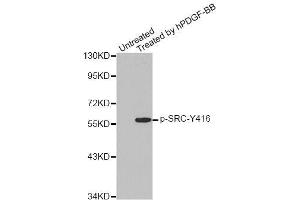 Western blot analysis of extracts from COLO205 cells, using Phospho-SRC-Y418 antibody (ABIN5969963). (Src 抗体  (pTyr418))