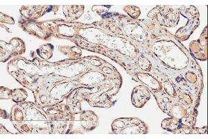 Immunohistochemistry (IHC) image for anti-CD274 (PD-L1) (C-Term) antibody (ABIN185339)