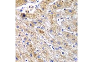 Immunohistochemistry of paraffin-embedded human liver injury using DPP3 antibody. (DPP3 抗体  (AA 1-280))