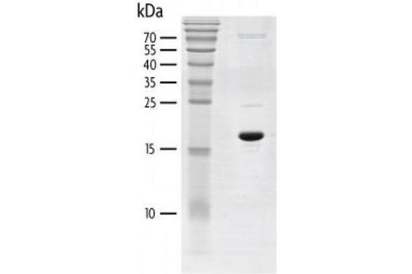 BRD3 Protein (AA 306-416) (His tag,DYKDDDDK Tag)