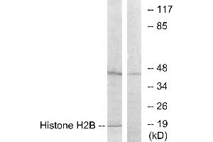 Immunohistochemistry analysis of paraffin-embedded human brain tissue using Histone H2B antibody. (Histone H2B 抗体)